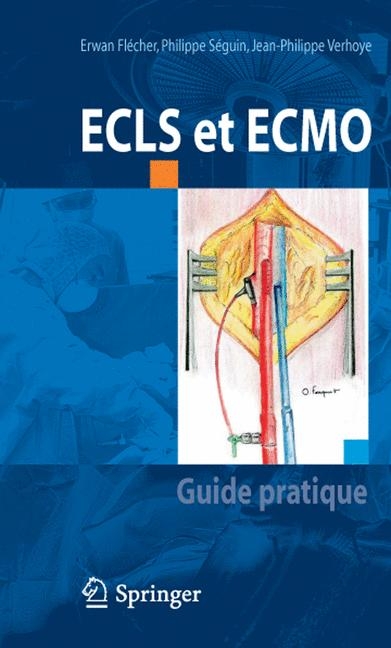 Ecls Et Ecmo - Erwan Flecher