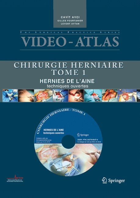 Videoatlas Chirurgie Herniaire Tome 1 - Cavit Avci