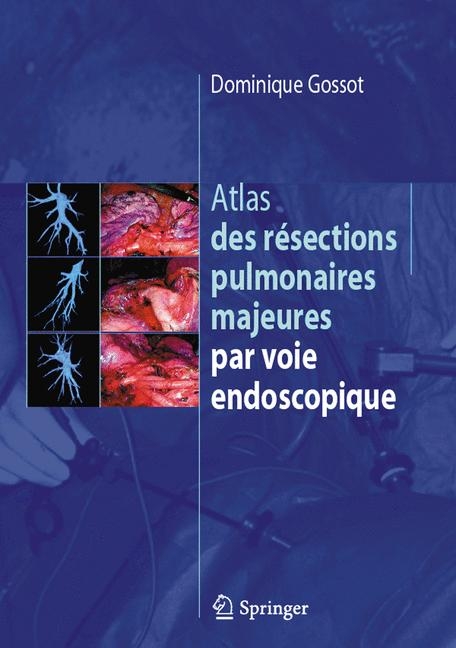 Atlas Des Resections Pulmonaires Majeures Par Voie Endoscopique - Dominique Gossot