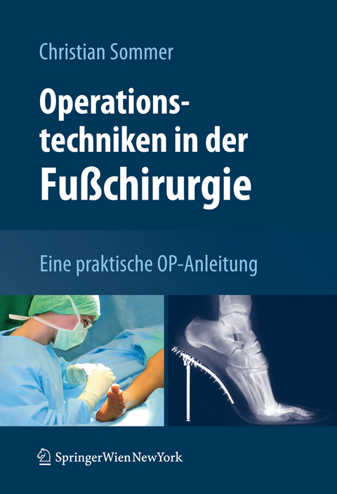 Operationstechniken in der Fußchirurgie - Christian Sommer