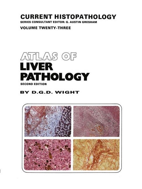 Atlas of Liver Pathology - D. G. D. Wight