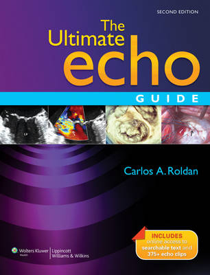 Ultimate Echo Guide -  Roldan