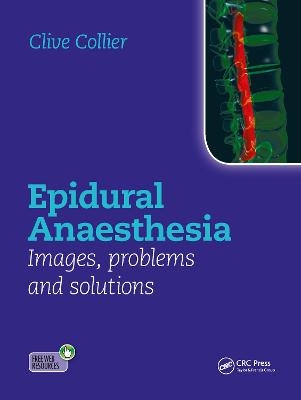 Epidural Anaesthesia: Images, Problems and Solutions - Clive Collier