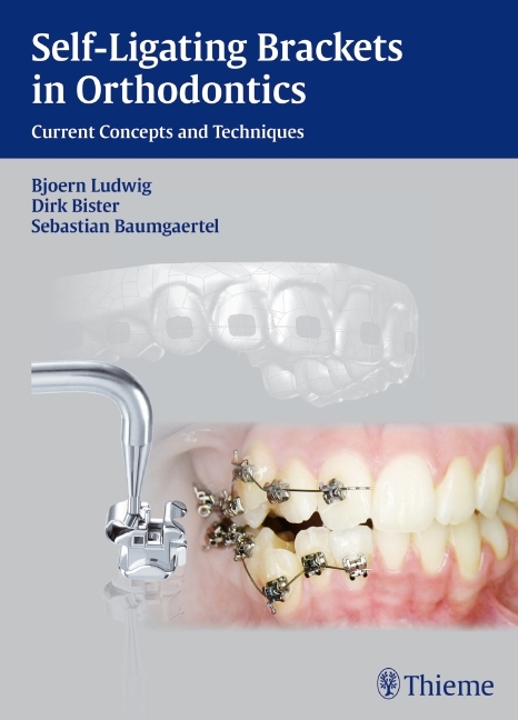 Self-ligating Brackets in Orthodontics - Björn Ludwig, Dirk Bister, Sebastian Baumgaertel