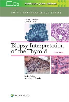 Biopsy Interpretation of the Thyroid - Scott L. Boerner, Sylvia L. Asa