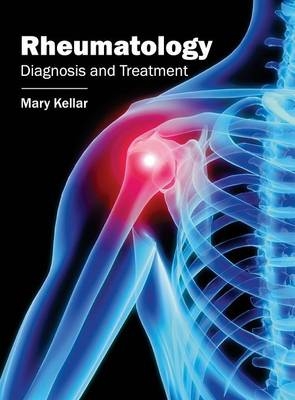 Rheumatology: Diagnosis and Treatment - 