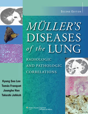 Muller's Diseases of the Lung - Kyung Soo Lee, Tomás Franquet, Dr. Joungho Han, Takeshi Johkoh