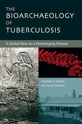 The Bioarchaeology of Tuberculosis - Charlotte A. Roberts, Jane E. Buikstra