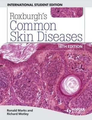 Common Skin Diseases - Ronald Marks, Richard Motley