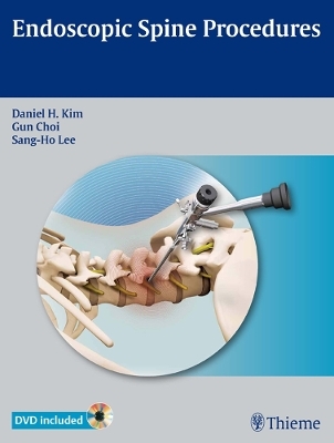 Endoscopic Spine Procedures - 