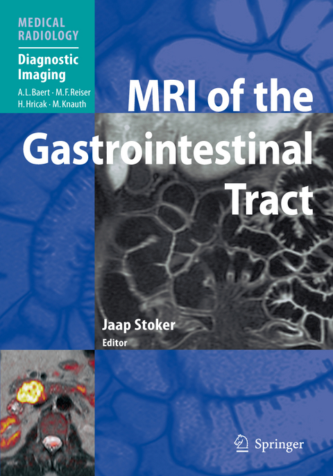 MRI of the Gastrointestinal Tract - 