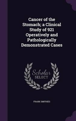 Cancer of the Stomach; a Clinical Study of 921 Operatively and Pathologically Demonstrated Cases - Frank Smithies