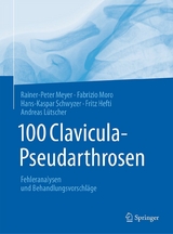 100 Clavicula-Pseudarthrosen - Rainer-Peter Meyer, Fabrizio Moro, Hans-Kaspar Schwyzer, Fritz Hefti