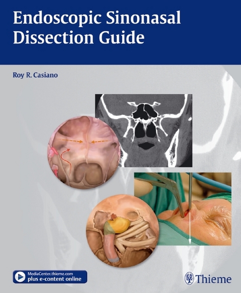 Endoscopic Sinonasal Dissection Guide - Roy R. Casiano