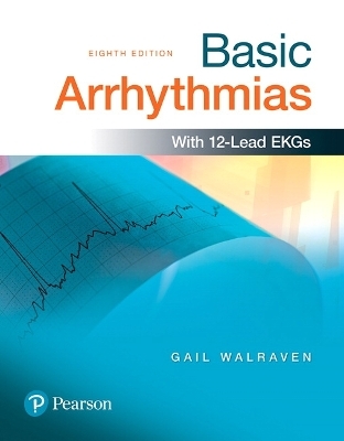 Basic Arrhythmias - Gail Walraven