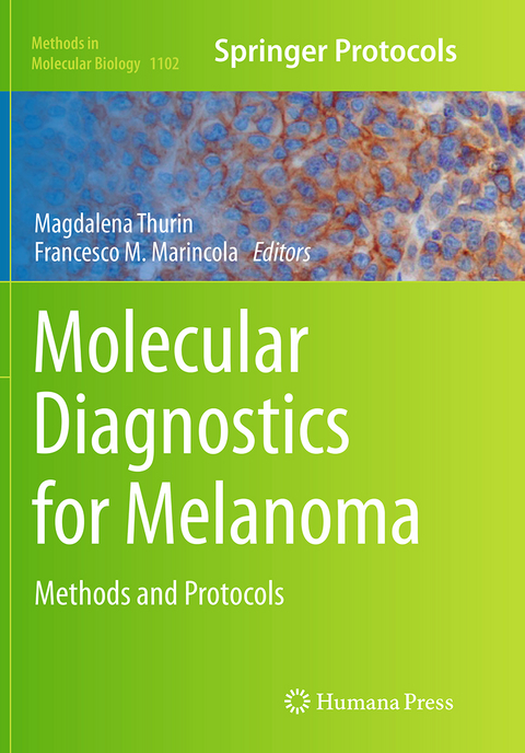 Molecular Diagnostics for Melanoma - 