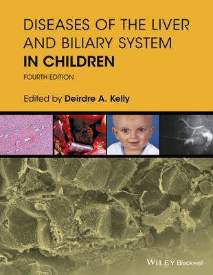 Diseases of the Liver & Biliary System in Children - 