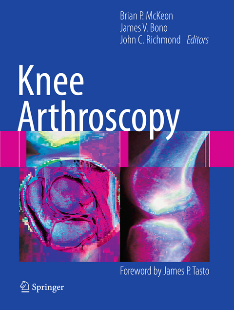 Knee Arthroscopy - 