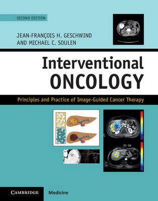 Interventional Oncology - 