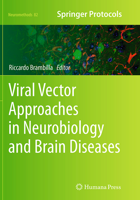 Viral Vector Approaches in Neurobiology and Brain Diseases - 