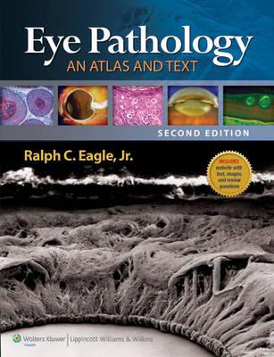 Eye Pathology - Ralph C Eagle