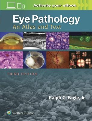 Eye Pathology - Ralph C. Eagle