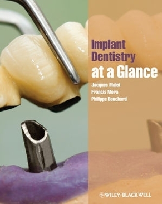 Implant Dentistry at a Glance - Jacques Malet, Francis Mora, Philippe Bouchard