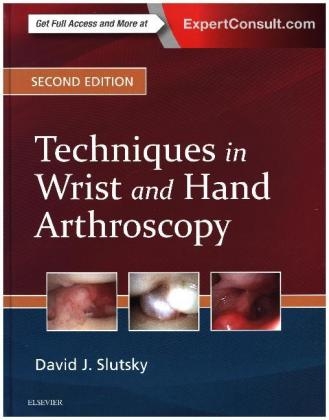 Techniques in Wrist and Hand Arthroscopy - David J. Slutsky