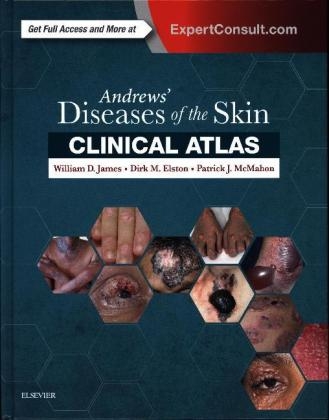 Andrews' Diseases of the Skin Clinical Atlas - William D. James, Dirk MD Elston, Patrick J. McMahon