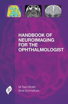 Handbook of Neuroimaging for the Ophthalmologist - M Tariq Bhatti, Ilona Schmalfuss