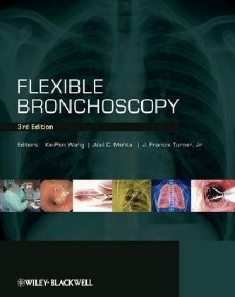 Flexible Bronchoscopy - 