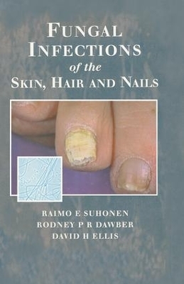 Fungal Infections of the Skin and Nails - Raimo E. Suhonen, Rodney P.R. Dawber, David H. Ellis