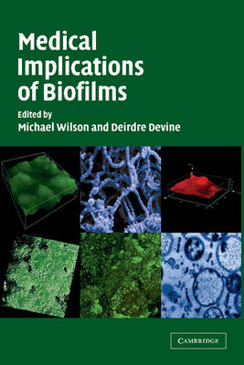 Medical Implications of Biofilms - 