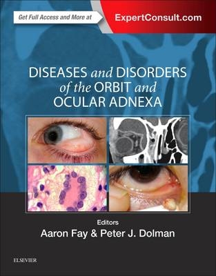 Diseases and Disorders of the Orbit and Ocular Adnexa - Aaron Fay, Peter J Dolman