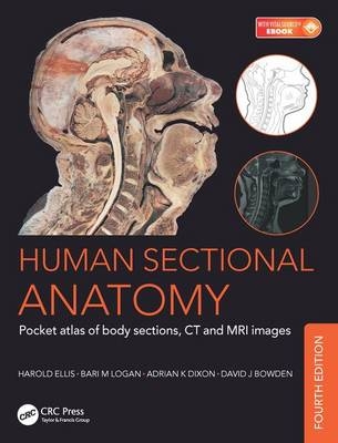 Human Sectional Anatomy - Adrian Kendal Dixon, David J. Bowden, Bari M. Logan, Harold Ellis