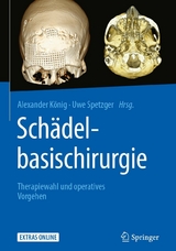 Schädelbasischirurgie - 