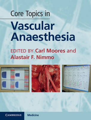 Core Topics in Vascular Anaesthesia - 