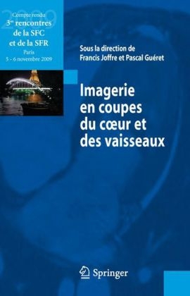 Imagerie En Coupes Du Coeur Et Des Vaisseaux - 