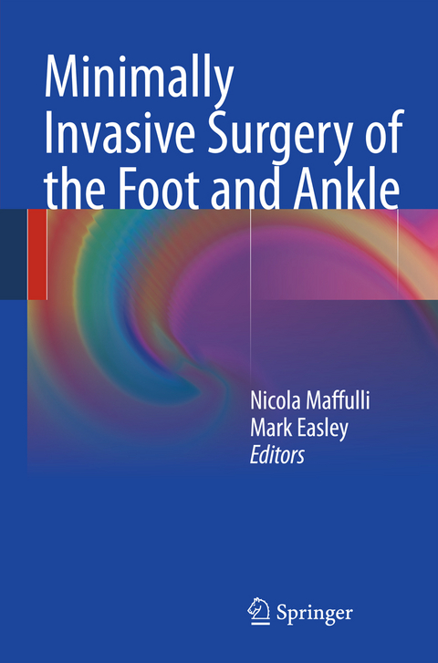 Minimally Invasive Surgery of the Foot and Ankle - 