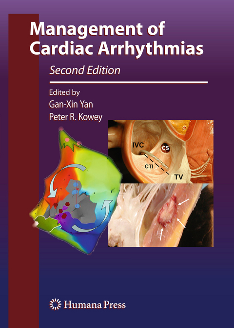 Management of Cardiac Arrhythmias - 