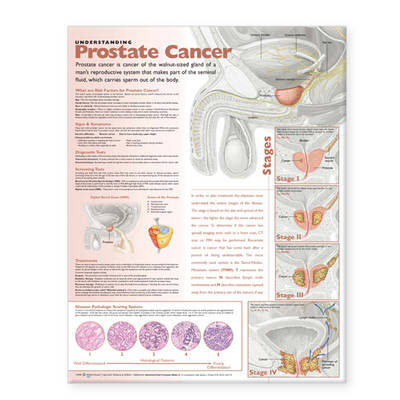 Understanding Prostate Cancer Anatomical Chart