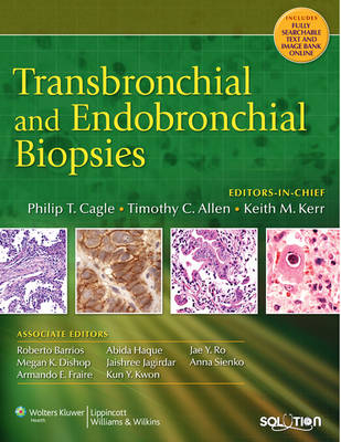 Transbronchial and Endobronchial Biopsies - Philip T. Cagle