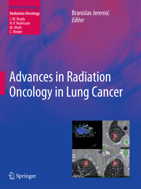 Advances in Radiation Oncology in Lung Cancer - 