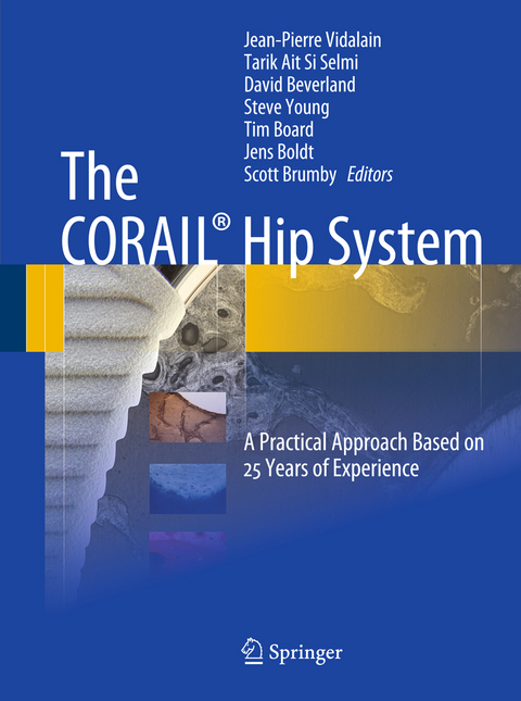 The CORAIL® Hip System - 