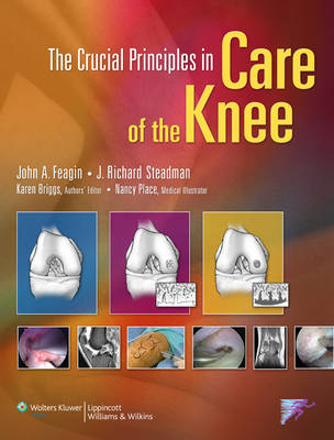 The Crucial Principles in Care of the Knee - 