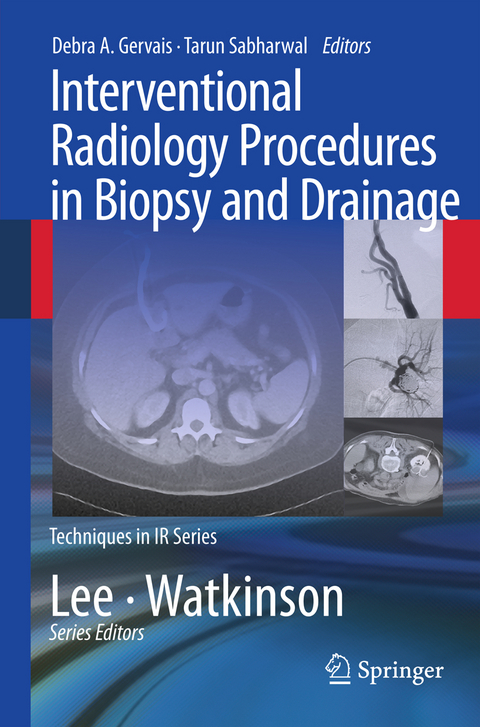 Interventional Radiology Procedures in Biopsy and Drainage - 