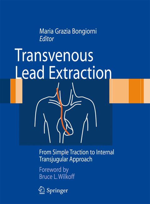 Transvenous Lead Extraction - 