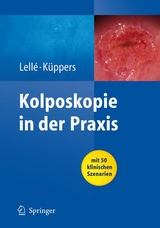 Kolposkopie in der Praxis - Ralph J. Lellé, Volkmar Küppers