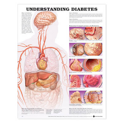 Understanding Diabetes Anatomical Chart