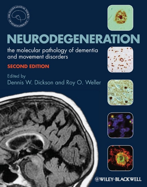 Neurodegeneration - 